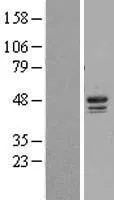 Caseïne Kinase 1 delta (CSNK1D) (NM 001893) Humane overexpressie Lysaat