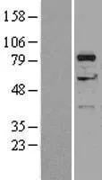 DGKA (NM 201444) Human Over-expression Lysate