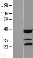 EIF4E (NM 001968) Human Over-expression Lysate