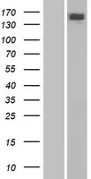 CSB (ERCC6) (NM 000124) Humane overexpressie Lysaat