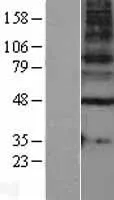 GABA A Receptor gamma 1 (GABRG1) (NM 173536) Humane Overexpressie Lysaat