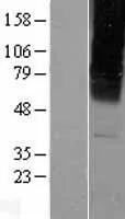 GABA A Receptor gamma 2 (GABRG2) (NM 198904) Humane Overexpressie Lysaat