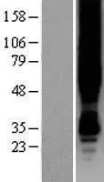 G eiwit gekoppelde receptor 30 (GPER1) (NM 001505) Humane overexpressie Lysaat