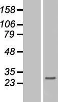 Histone H1.3 (HIST1H1D) (NM 005320) Humane overexpressie Lysaat
