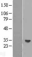 Geboortedatum: (HLA-DOB) (NM 002120)