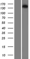 Isoleucyl tRNA synthetase (IARS) (NM 013417) Humane overexpressie-lysaat