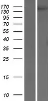 VEGF Receptor 2 (KDR) (NM 002253) Humane Overexpressie Lysaat