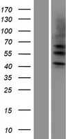 Cytokeratine 4 (KRT4) (NM 002272) Humane overexpressie Lysaat