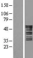 Cytokeratine 8 (KRT8) (NM 002273) Humane overexpressie Lysaat