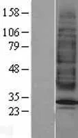 MC2 receptor (MC2R) (NM 000529) Humane overexpressie Lysaat