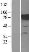 MTRR (NM 024010) Menselijke overexpressie Lysaat