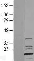 Myosine lichtketen 1 (MYL1) (NM 079422) Humane overexpressie Lysaat