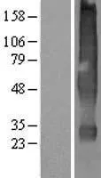 Solute carrier familie 22 lid 18 (SLC22A18) (NM 002555) Human Over-expression Lysate