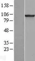 PDE6 beta (PDE6B) (NM 000283) Humane overexpressie Lysaat