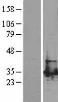 PGAM1 (NM 002629) Humane overexpressie Lysaat