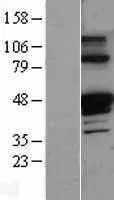 Alpha 1 Antitrypsine (SERPINA1) (NM 000295) Humane overexpressie Lysaat