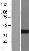 PITX2 (NM 153427) Humane overexpressie Lysaat