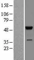 JNK2 (MAPK9) (NM 139068) Humane overexpressie Lysaat