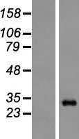 Proteasome subunit alpha type 6 (PSMA6) (NM 002791) Humane overexpressie Lysaat