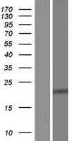 RPE (NM 199229) Human Over-expressie Lysaat