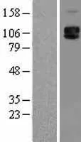 CD62P (SELP) (NM 003005) Human Over-expression Lysate