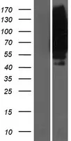SLC19A1 (NM 194255) Humane overexpressie Lysaat