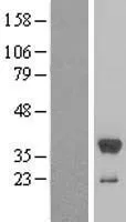 Estrogeen Sulfotransferase (SULT1E1) (NM 005420) Humaan overexpressielysaat