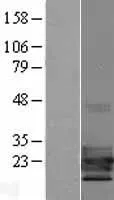 TCF21 (NM 198392) Human Over-expressie Lysaat