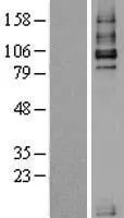TGF beta Receptor III (TGFBR3) (NM 003243) Humane Overexpressie Lysaat