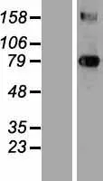 Transglutaminase 3 (TGM3) (NM 003245) Humane overexpressie Lysaat