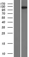 Transcriptie beëindigingsfactor 1 (TTF1) (NM 007344) Humane overexpressie Lysaat