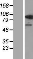 USP1 (NM 001017415) Human Over-expression Lysaat