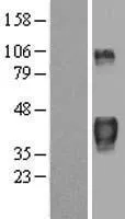 Tristetraproline (ZFP36) (NM 003407) Humane overexpressie Lysaat