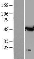 Alpha Tubulin (TUBA1A) (NM 006009) Humane overexpressie Lysaat