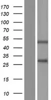 SSPN (NM 005086) Human Over-expression Lysaat