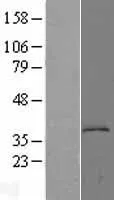 L Kynurenine Hydrolase (KYNU) (NM 003937) Humane overexpressie Lysaat
