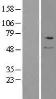 Serine Palmitoyltransferase (SPTLC2) (NM 004863) Humane overexpressie Lysaat