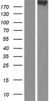 CDC42 Bindende Proteïne Kinase Beta (CDC42BPB) (NM 006035) Humaan Overexpressie Lysaat