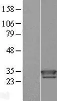 Thioredoxin domein met 9 (TXNDC9) (NM 005783) Humane overexpressie Lysaat