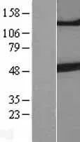 Beta III Tubulin (TUBB3) (NM 006086) Humane overexpressie Lysaat