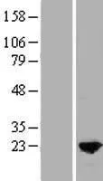 MYL9 (NM 006097) Humaan over-expressielysaat