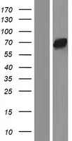 TESK2 (NM 007170) Humane overexpressie Lysaat