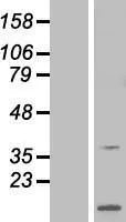 ARPP21 (NM 198399) Human Over-expressie Lysaat