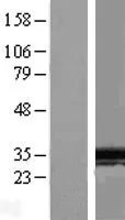 Spindline 1 (SPIN1) (NM 006717) Humane overexpressie Lysaat
