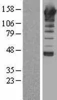 Fosfolipase C beta 1 (PLCB1) (NM 015192) Humane overexpressie Lysaat