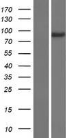 JIP2 (MAPK8IP2) (NM 016431) Humane overexpressie Lysaat