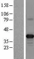 Apolipoproteïne L 2 (APOL2) (NM 030882) Humane overexpressie Lysaat