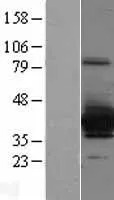 SULT4A1 (NM 014351) Humane overexpressie Lysaat