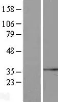 GCIP interacting protein p29 (SYF2) (NM 015484) Humane overexpressie Lysaat