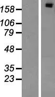 SIPA1L1 (NM 015556) Humane overexpressie Lysaat